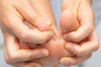 Athlete’s Foot and How to Find Relief